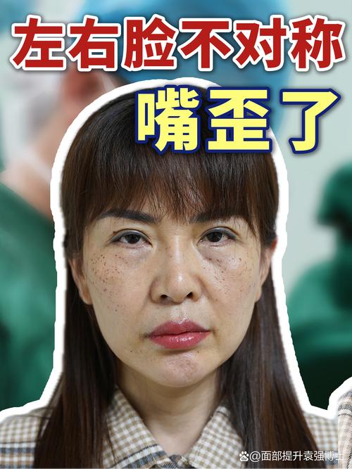 拍照时感觉自己嘴歪_镜头脸歪？可能是咀嚼单边或健康问题
