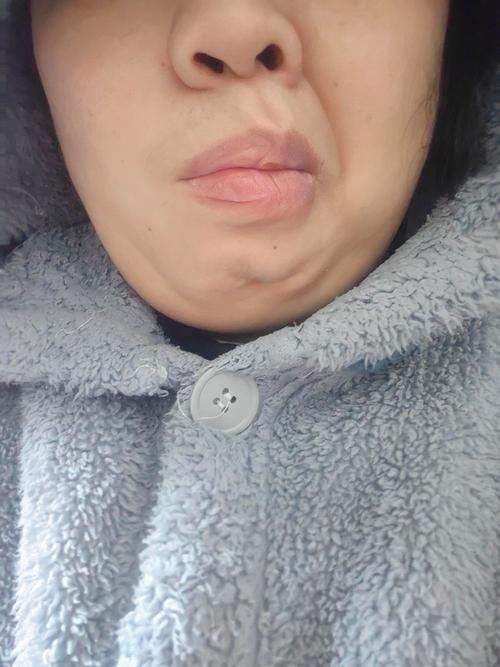 拍照时感觉自己嘴歪_镜头脸歪？可能是咀嚼单边或健康问题