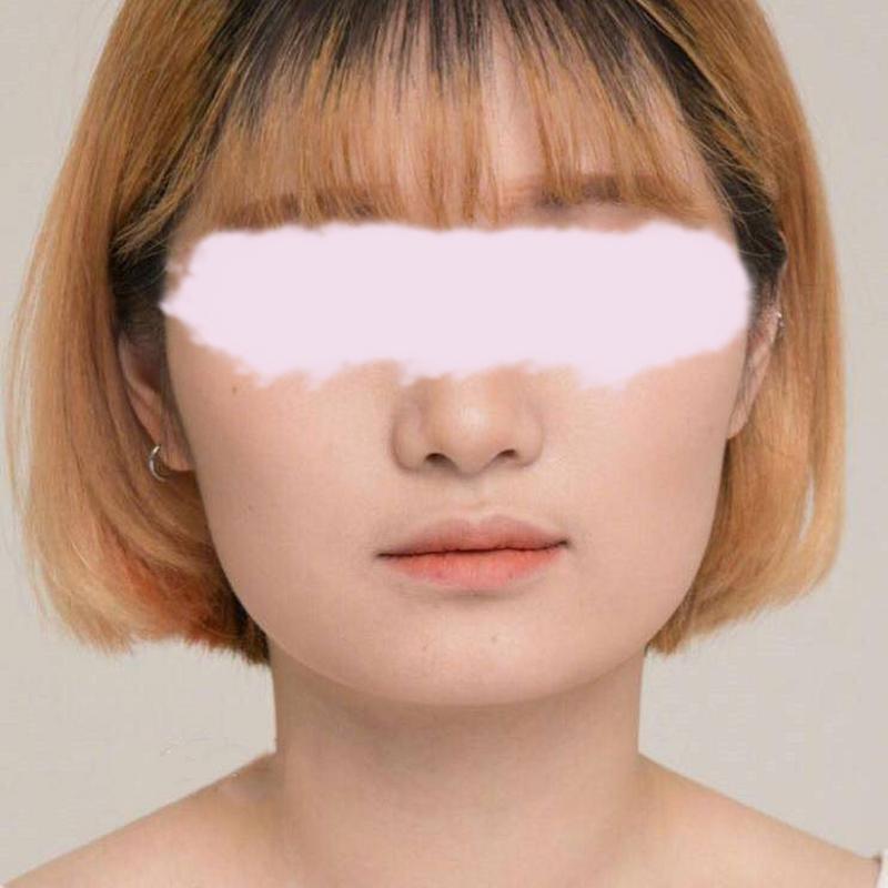 怎么修图下巴变宽_下巴宽度调整,美图秀秀甜盐相机助你自然变美 怎么修图下巴变宽_下巴宽度调整,美图秀秀甜盐相机助你自然变美