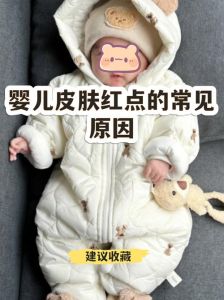 宝宝拍照红点点在哪_可能是痤疮尿布疹或过敏