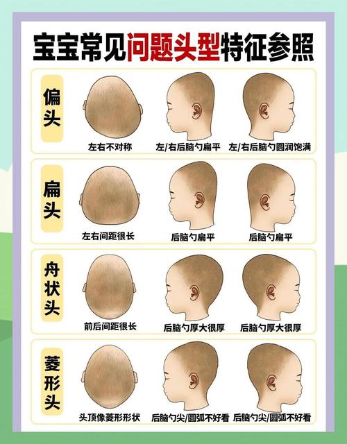 宝宝头型图拍照_宝宝头型圆扁有讲究，科学护理助健康成长