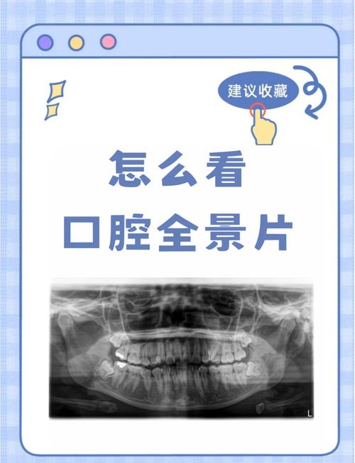 口腔照相参数_口腔摄影调参数，准确记录口腔细节