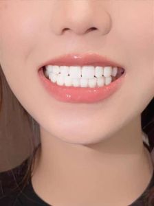 能美白牙齿的修图软件_牙齿美白工具多又好，快速变美选美图秀秀