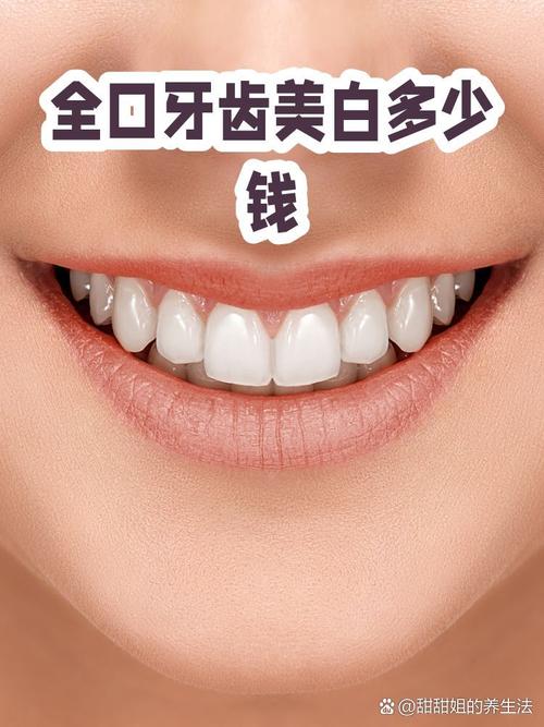 牙齿美白全口图片_并非越白越好，选对方式笑出自然自信
