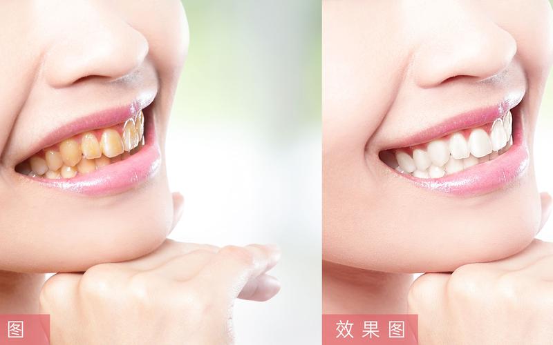 能美白牙齿的修图软件_牙齿美白工具多又好，快速变美选美图秀秀
