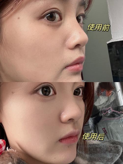 脸部磨皮图片前后对比_美化照片，去除瑕疵，自然效果