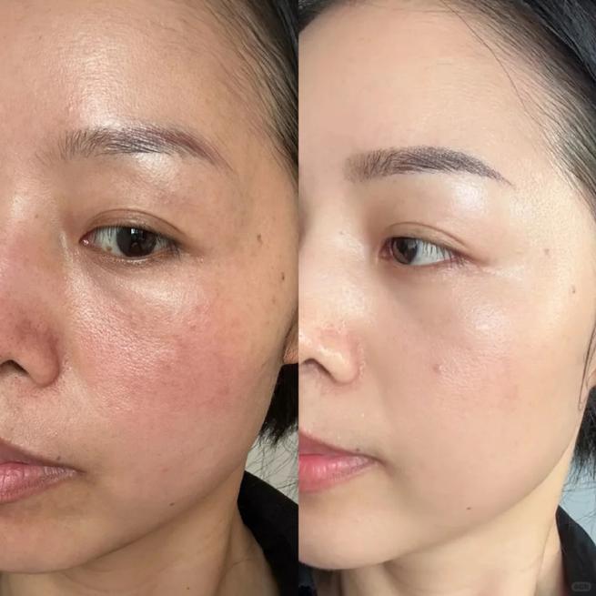美白图片真实前后对比_明星也怕晒？健康美白才持久！