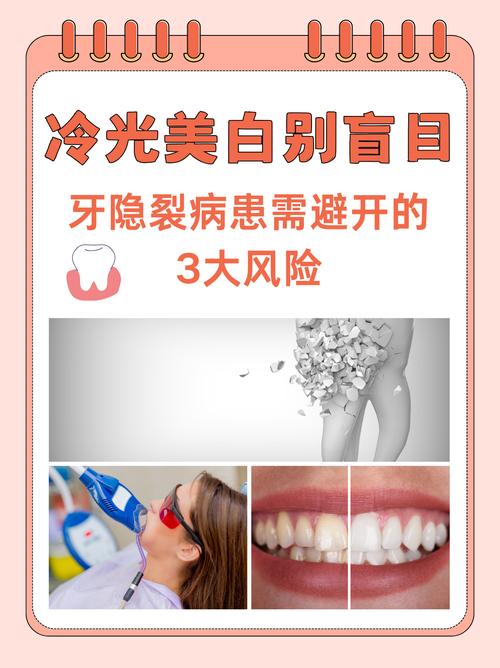 牙齿冷光美白后悔死了_冷光美白有风险？术后护理和潜在问题需了解