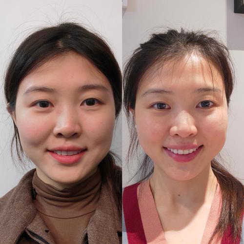 美颜苹果模式是真实的自己吗_苹果人像模式真实细腻，适合修图，安卓美颜便捷亚洲肤色