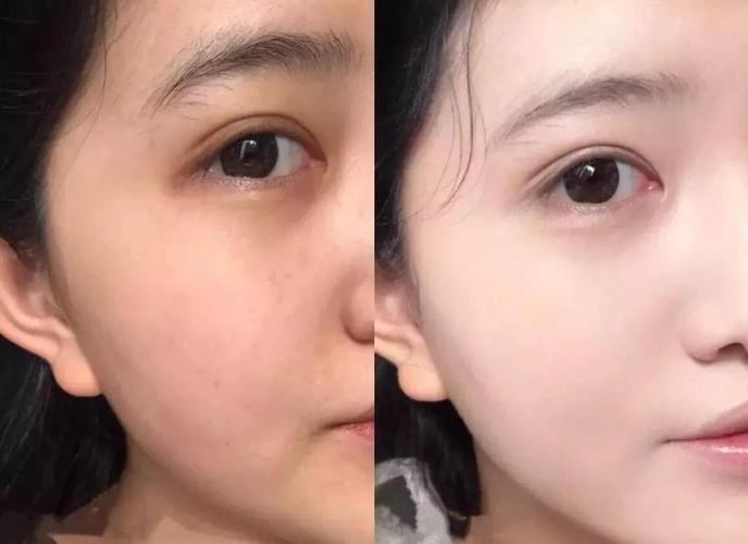 全身美白对比高清图_角质厚难美白？先去角质，选对精华！