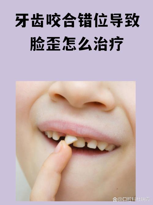为啥拍照嘴巴歪的怎么补救_嘴巴歪斜拍照怎么办? 为啥拍照嘴巴歪的怎么补救_嘴巴歪斜拍照怎么办?