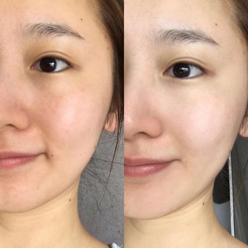 美白图片真实前后对比_明星也怕晒？健康美白才持久！