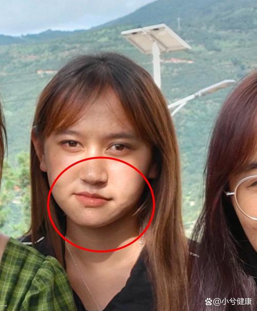为什么镜子里嘴巴不歪拍照就歪_照镜子五官对称，拍照却歪斜？原因与改善方法