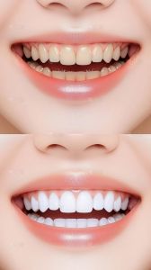 牙齿美白有几种方式_超声波漂洗贴面等哪种好？