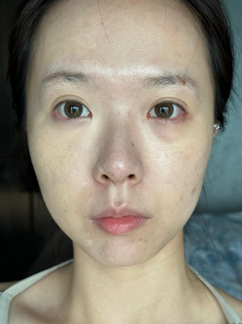 修改人物面部瑕疵原图_快速去除痘痘,AI自动修复 修改人物面部瑕疵原图_快速去除痘痘,AI自动修复
