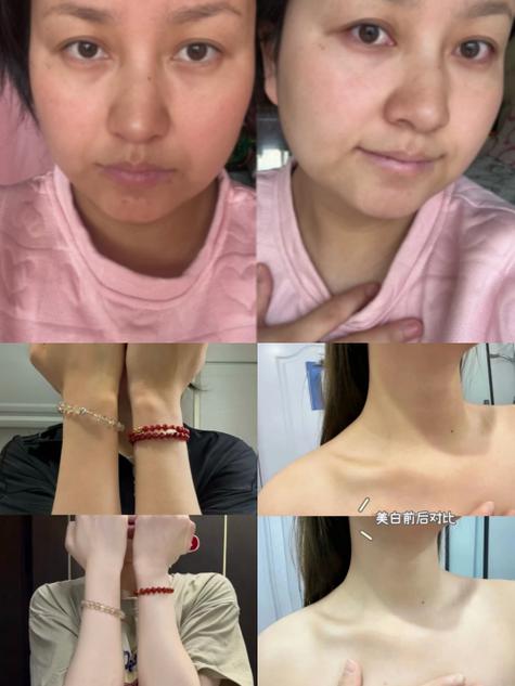 全身美白对比高清图_角质厚难美白？先去角质，选对精华！