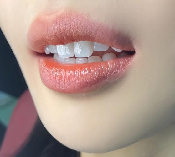 牙齿美白后的照片_小杨牙齿发黄专业美白自信笑容