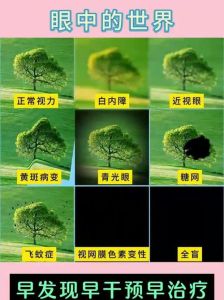 看远看近模糊的图片_看远近模糊？可能是远视或散光！