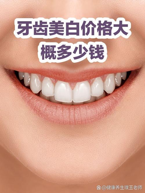 牙齿美白是永久的吗_冷光美白牙齿，术后护理很关键！