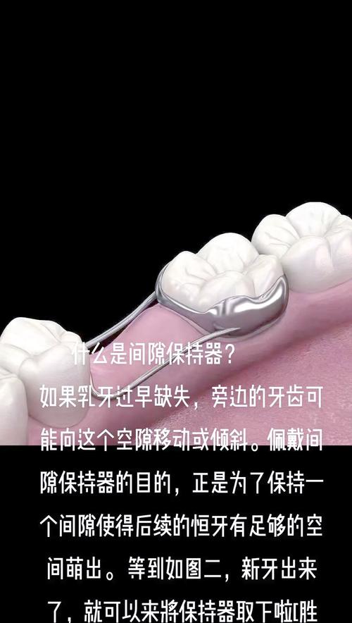 保持器图片高清大图_选哪个？
