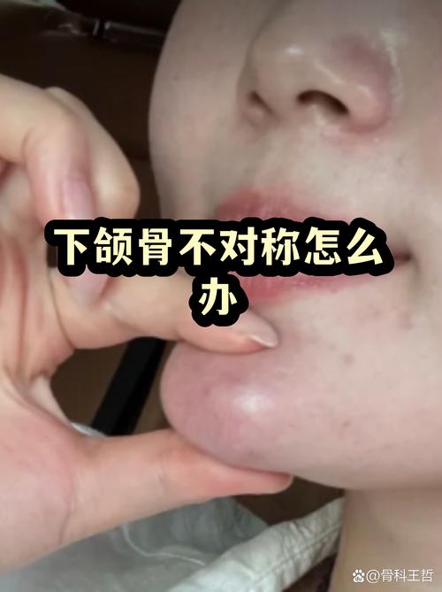 为啥脸拍照是不对称的_拍照脸不对称?多是姿势问题! 为啥脸拍照是不对称的_拍照脸不对称?多是姿势问题!